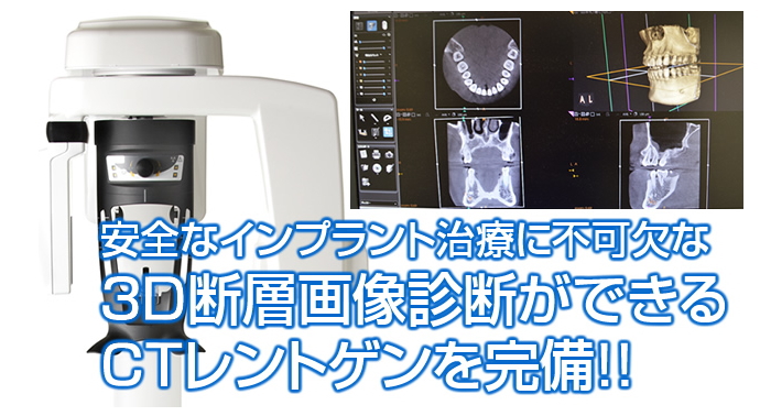 歯科用ＣＴを完備