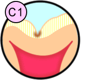 Ｃ１