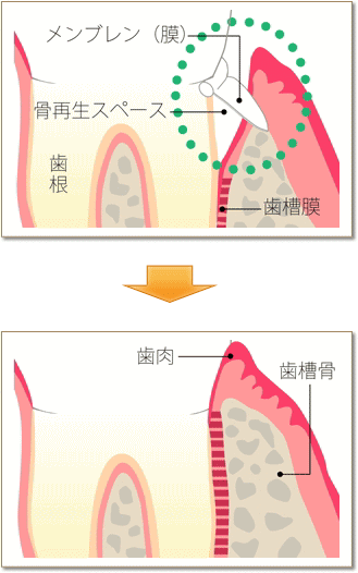 ＧＴＲ法