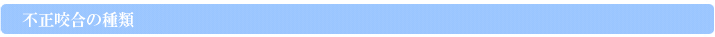 不正咬合の種類