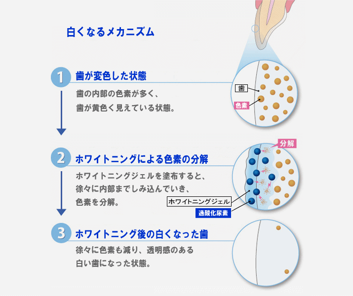 白くなるメカニズム